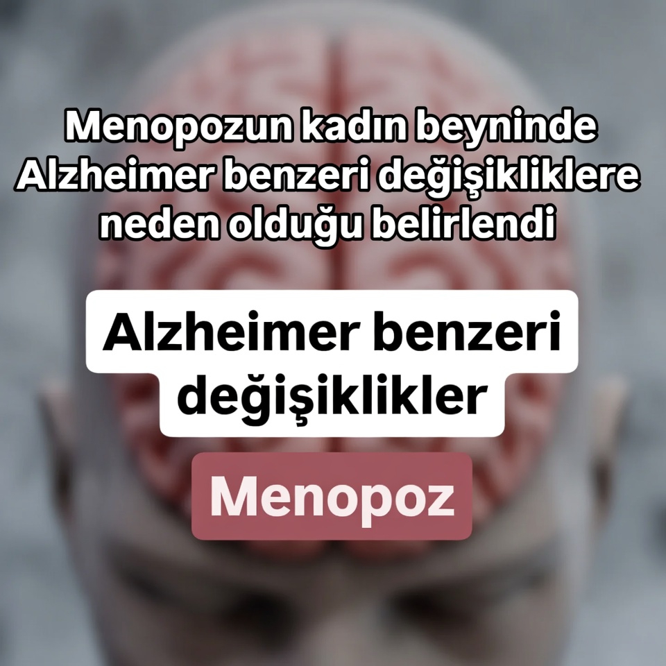 Menopozun Kadın Beyninde Alzheimer Benzeri Değişikliklere Neden Olduğu Belirlendi